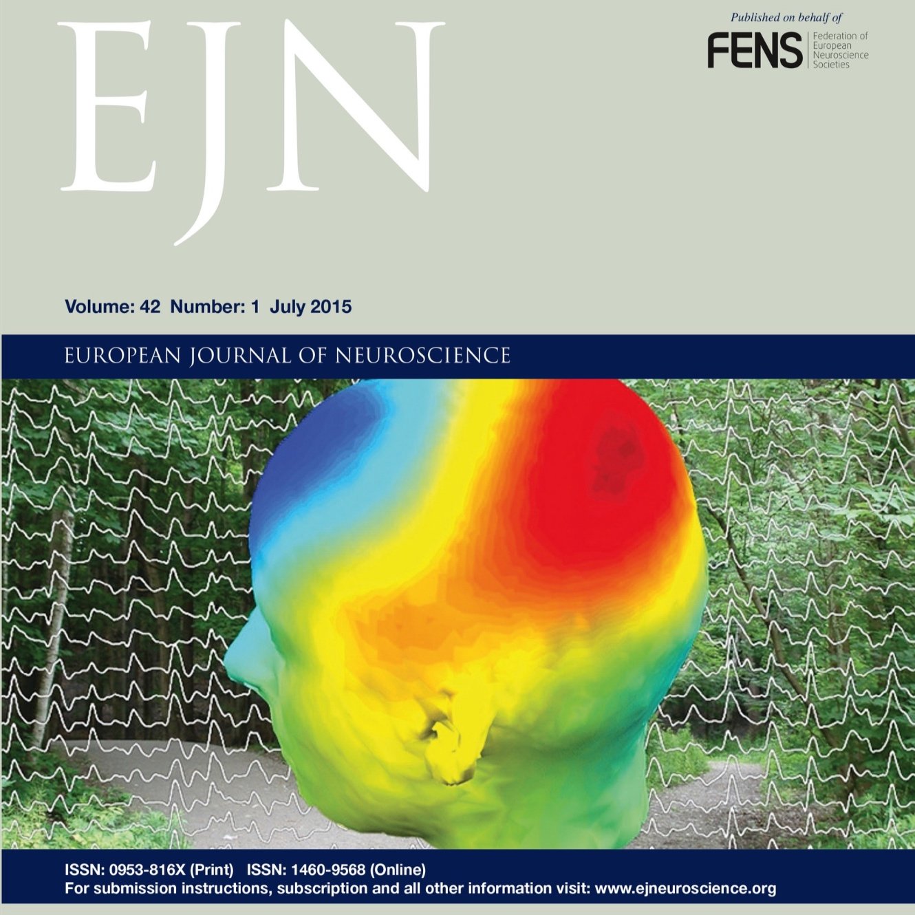 Acute inhibition of a cortical motor area impairs vocal control in singing zebra finches