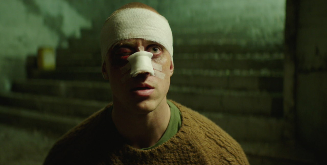 Injured man with bandages on his head and nose in Valkyrien, cinematography by Johan-Fredrik Bødtker.