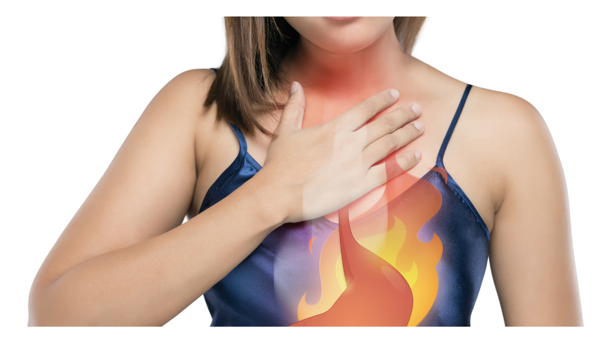 How to Stop GERD Naturally: The Ultimate Guide to Alginates and Mucilaginous Herbs