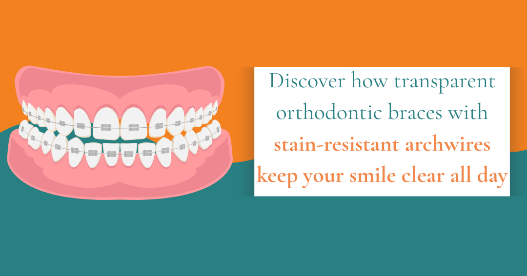 Transparent Orthodontic Braces in Whittier: How New Stain-Resistant Archwires Keep Your Smile Clear All Day