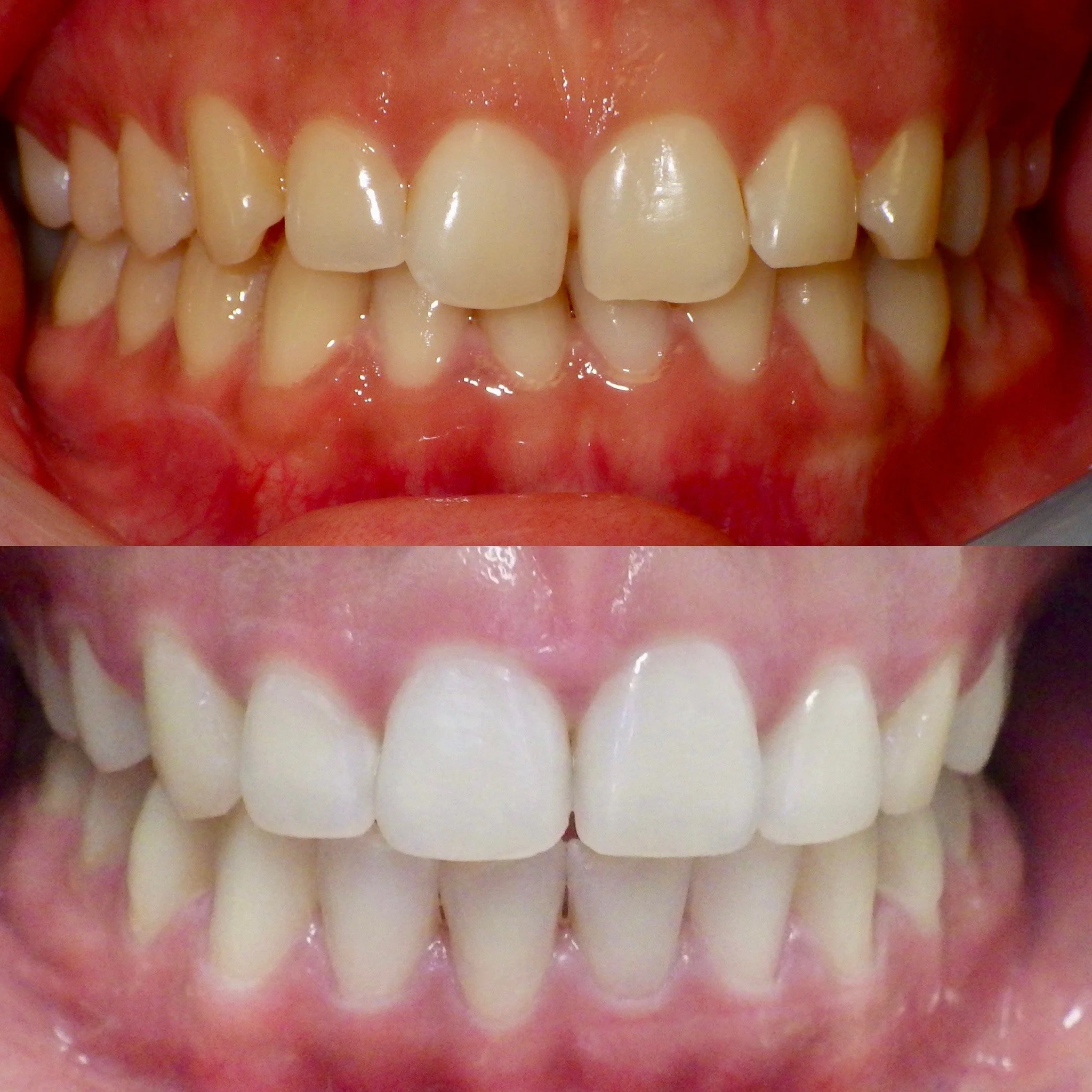 Textbook Orthodontics Named #1 Orthodontist in the San Fernando Valley for 2025 &amp; 2026!