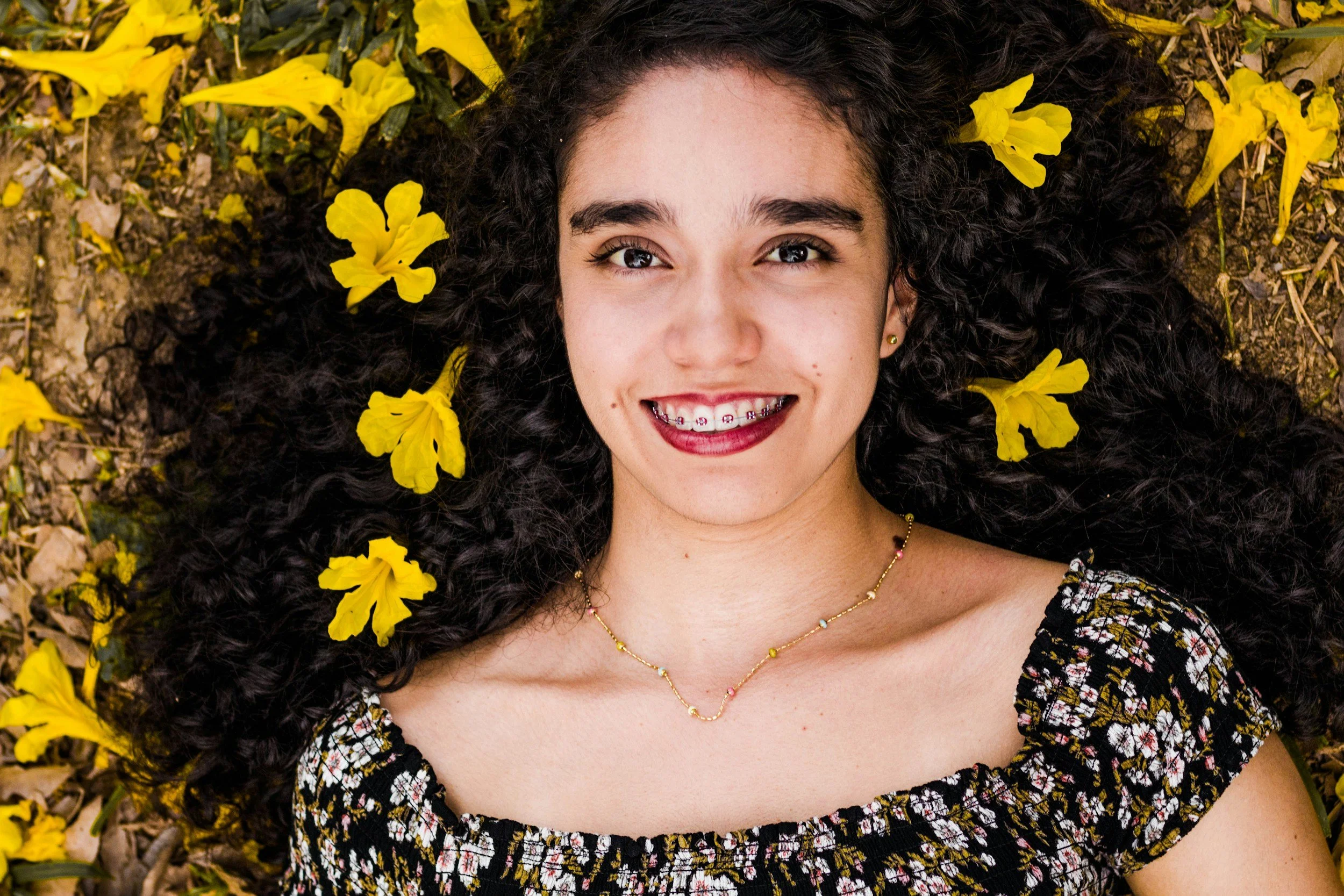 Qué revisa un ortodoncista antes de recomendar brackets o Invisalign