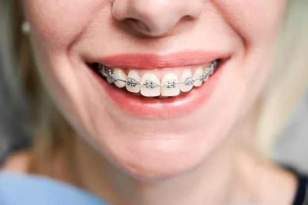 How to Prevent Ceramic Braces from Staining