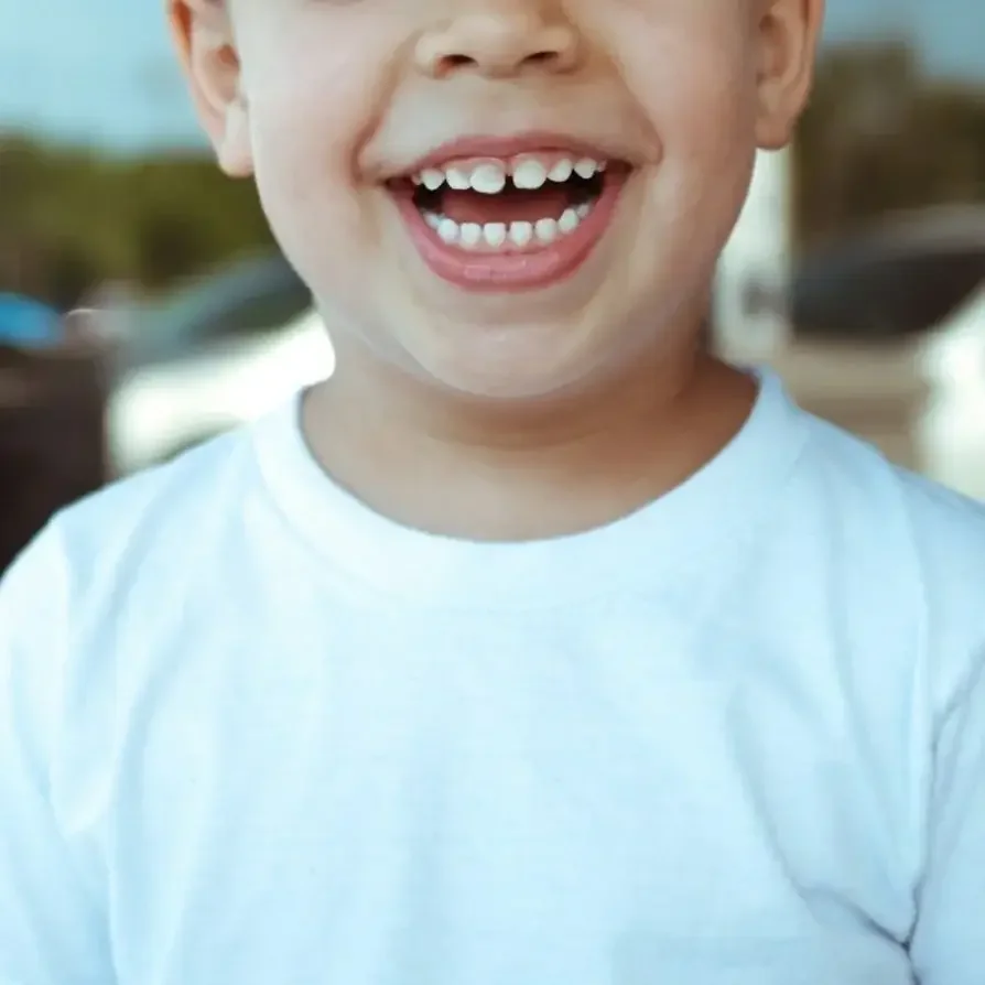 Close-up of a child's smiling face, showing teeth, wearing a white t-shirt, with a blurred outdoor background.