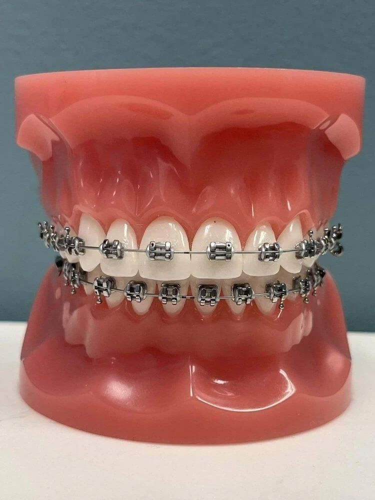 Tratamiento con ortodoncia en Los Ángeles