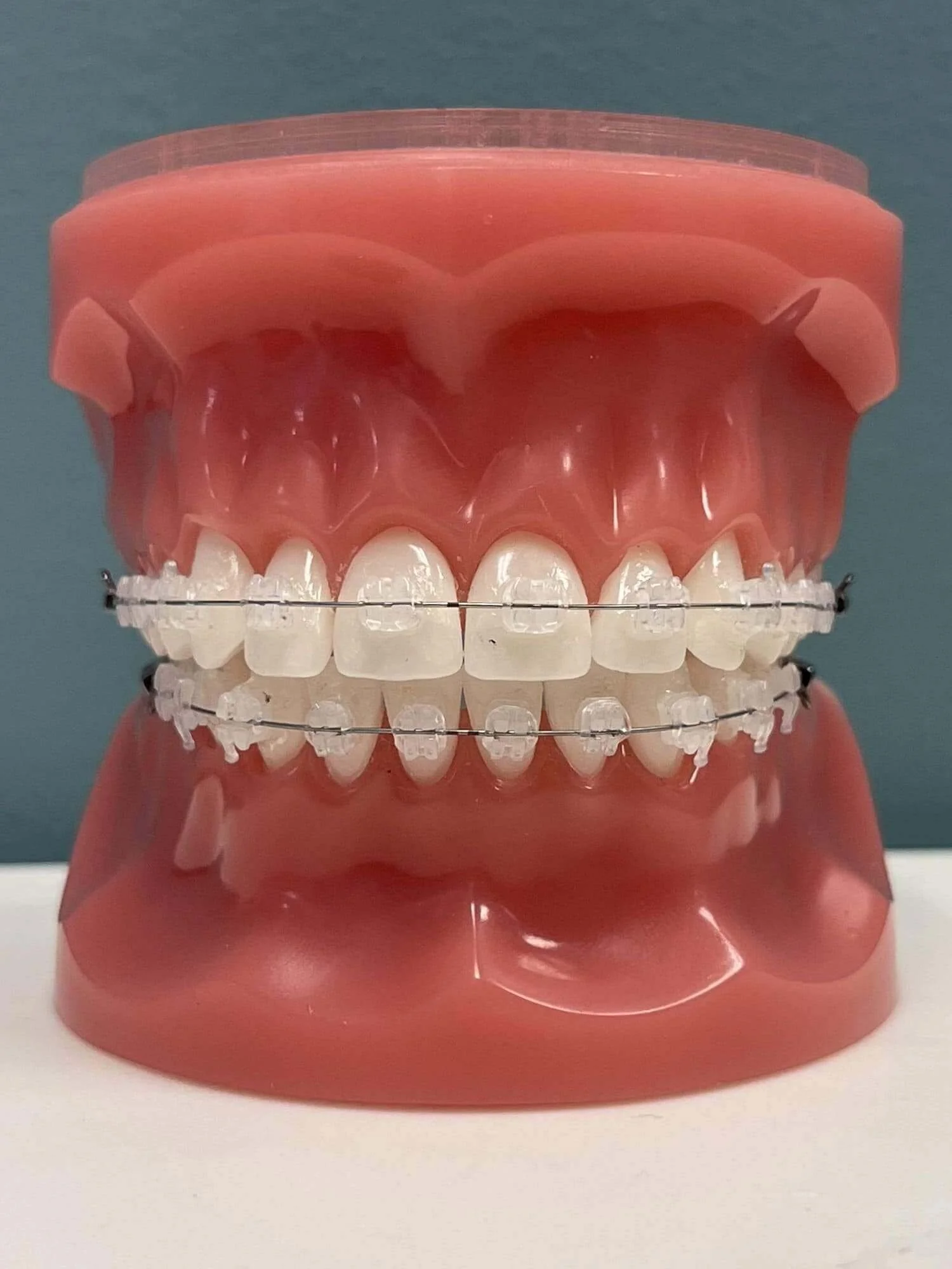 Brackets transparentes en Los Angeles