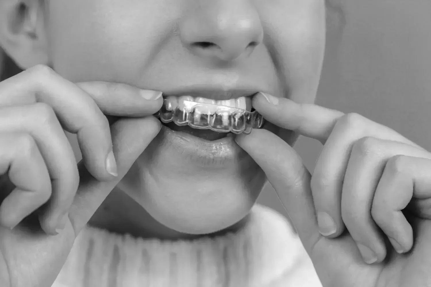 A woman putting on clear dental braces on her teeth.