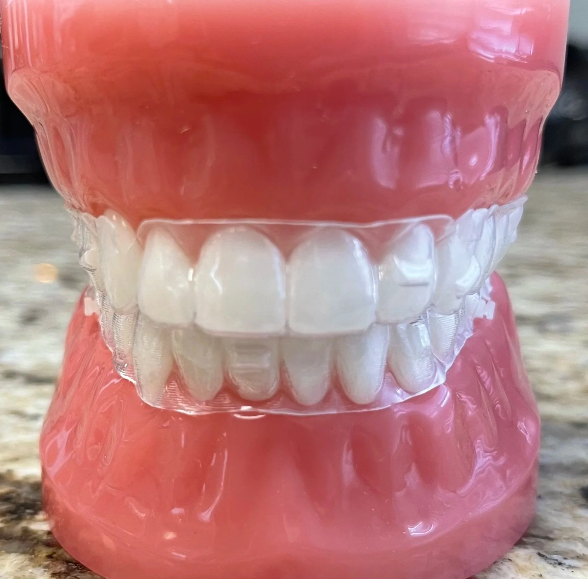 Alineadores transparentes Los Angeles