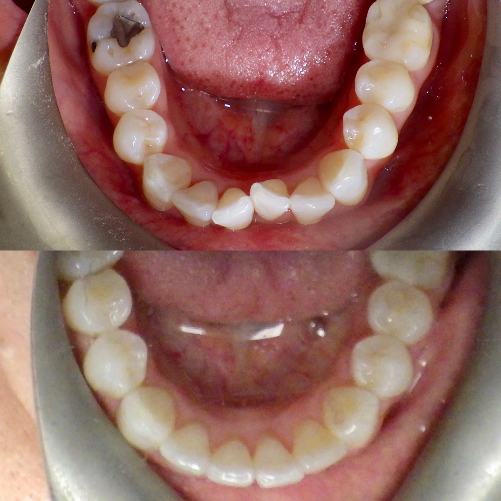 clear Aligners in inglewood