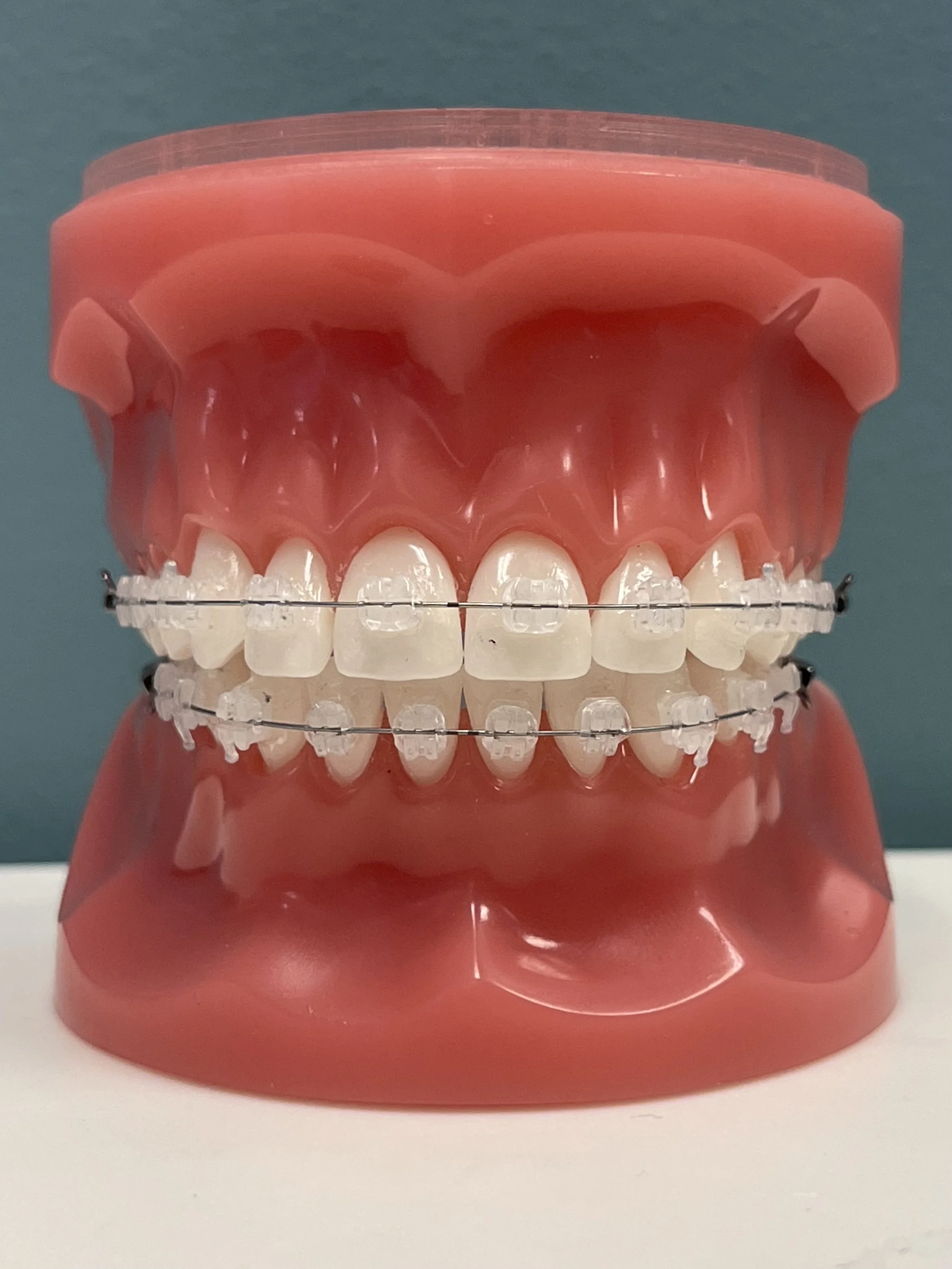 Orthodontist in Los Angeles & Whittier Braces & Invisalign