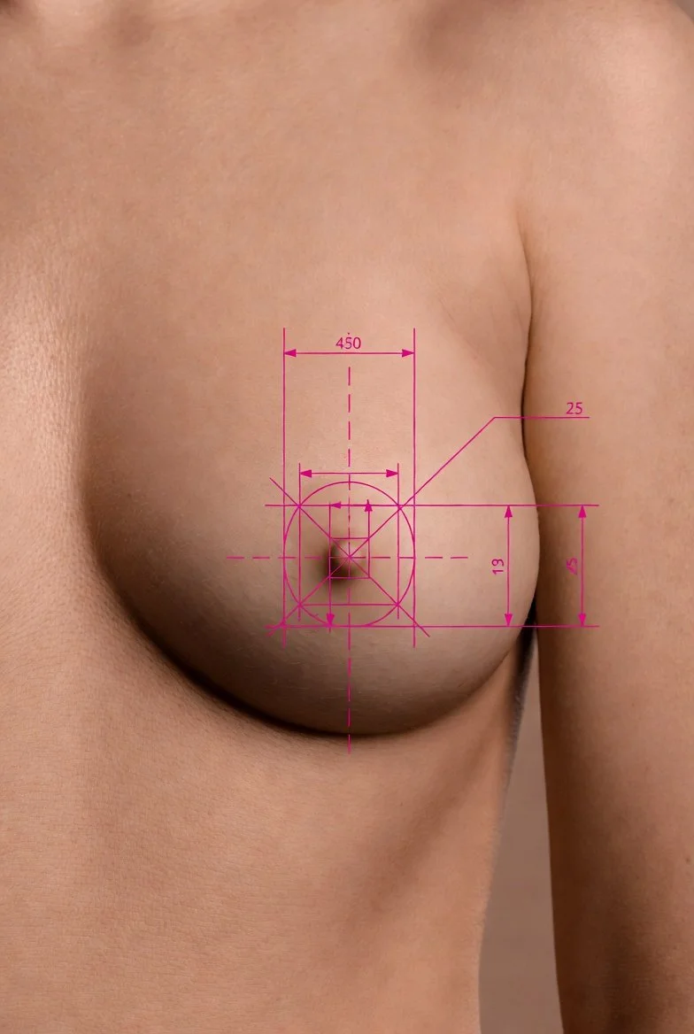 Tatouage de la plaque aréolo-mamelonnaire