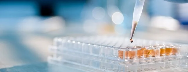 Relapsed or Refractory Large B-Cell Lymphoma Clinical Trial