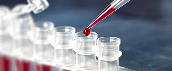 Clinical Trial