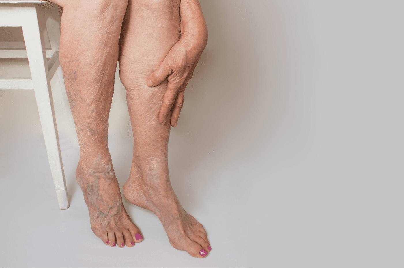 radiofrequency treatment for varicose veins