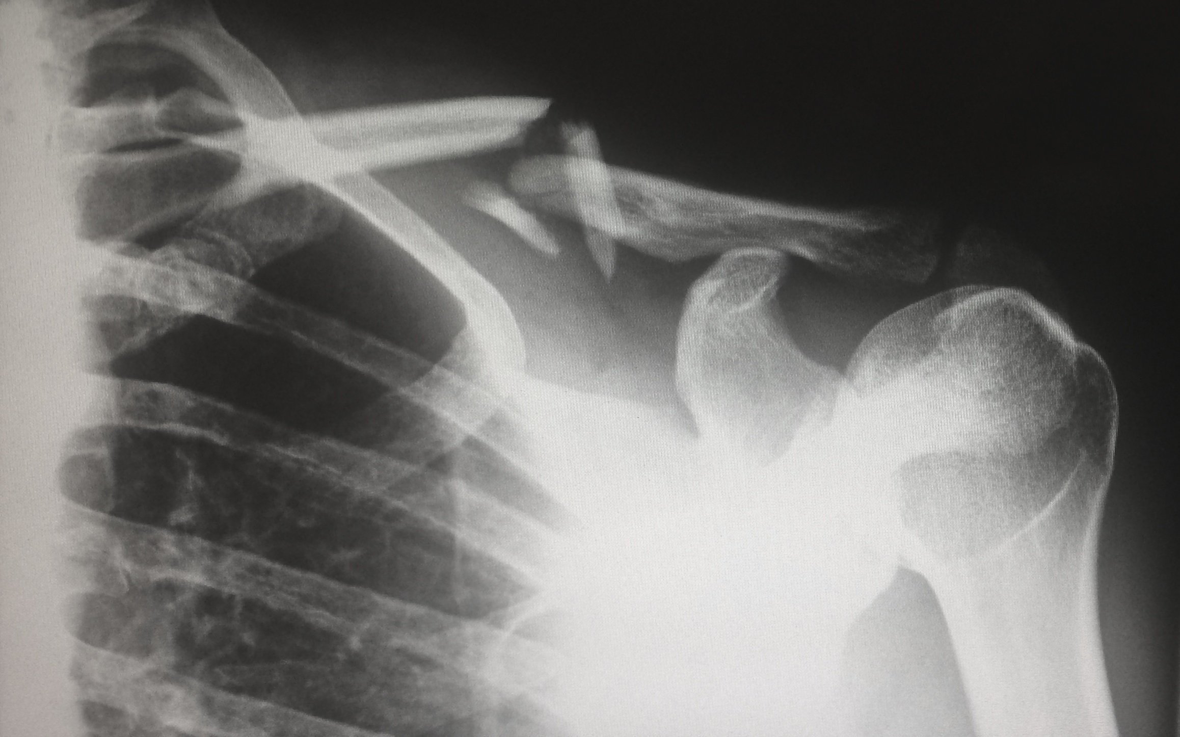 Do I need an X-Ray, MRI, CT scan or Ultrasound Scan? What are the differences?