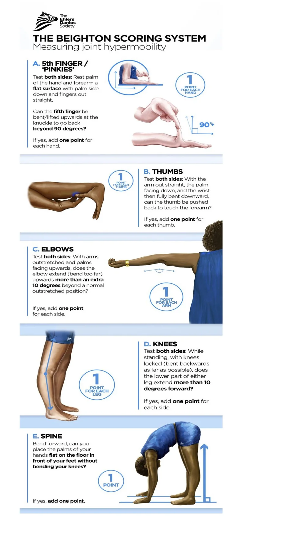 Hypermobility (“Double-Jointed”) — What It Means & How We Can Help ...