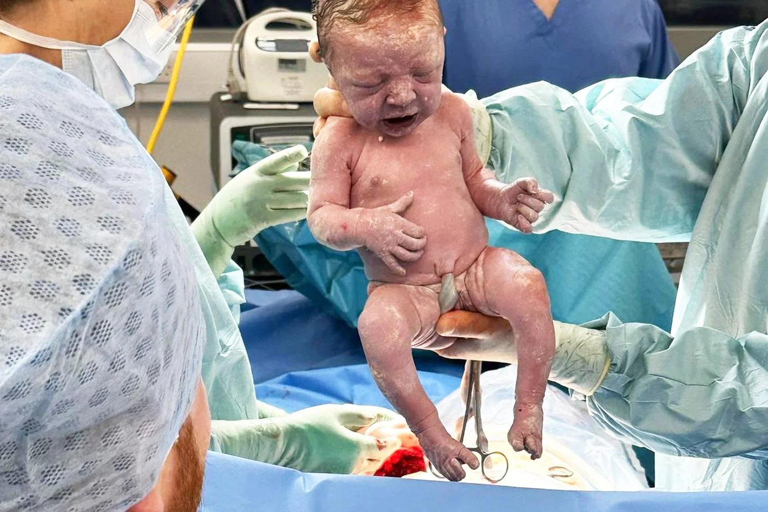 Embracing the Safest Option - Positive C-Section Birth Story