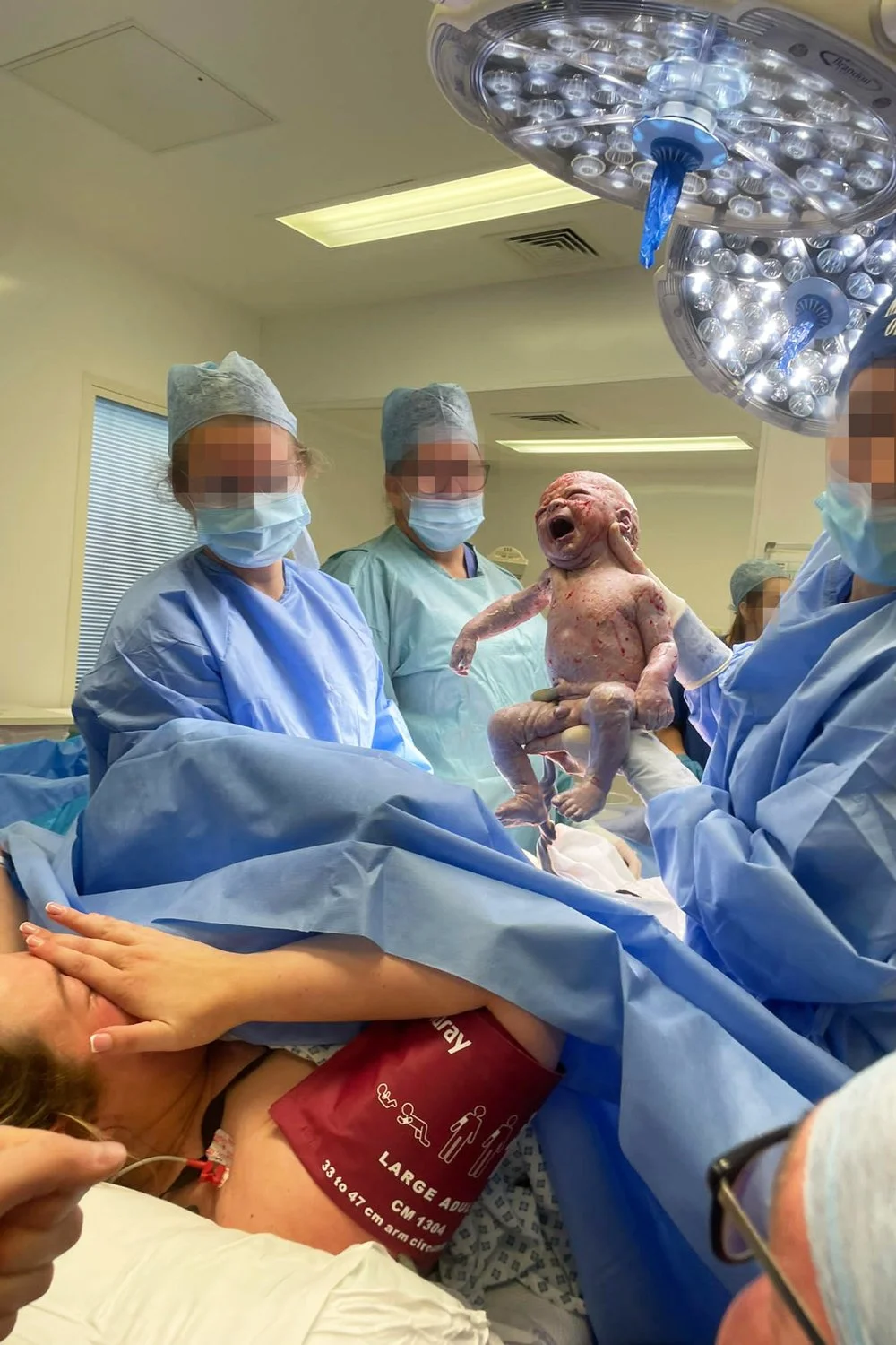 C-Section After Baby Loss - Positive Birth Story