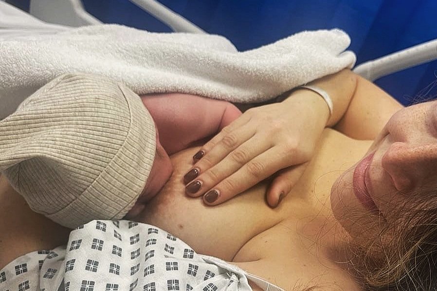 Breastfeeding After A C-section Birth: Everything You Should Know