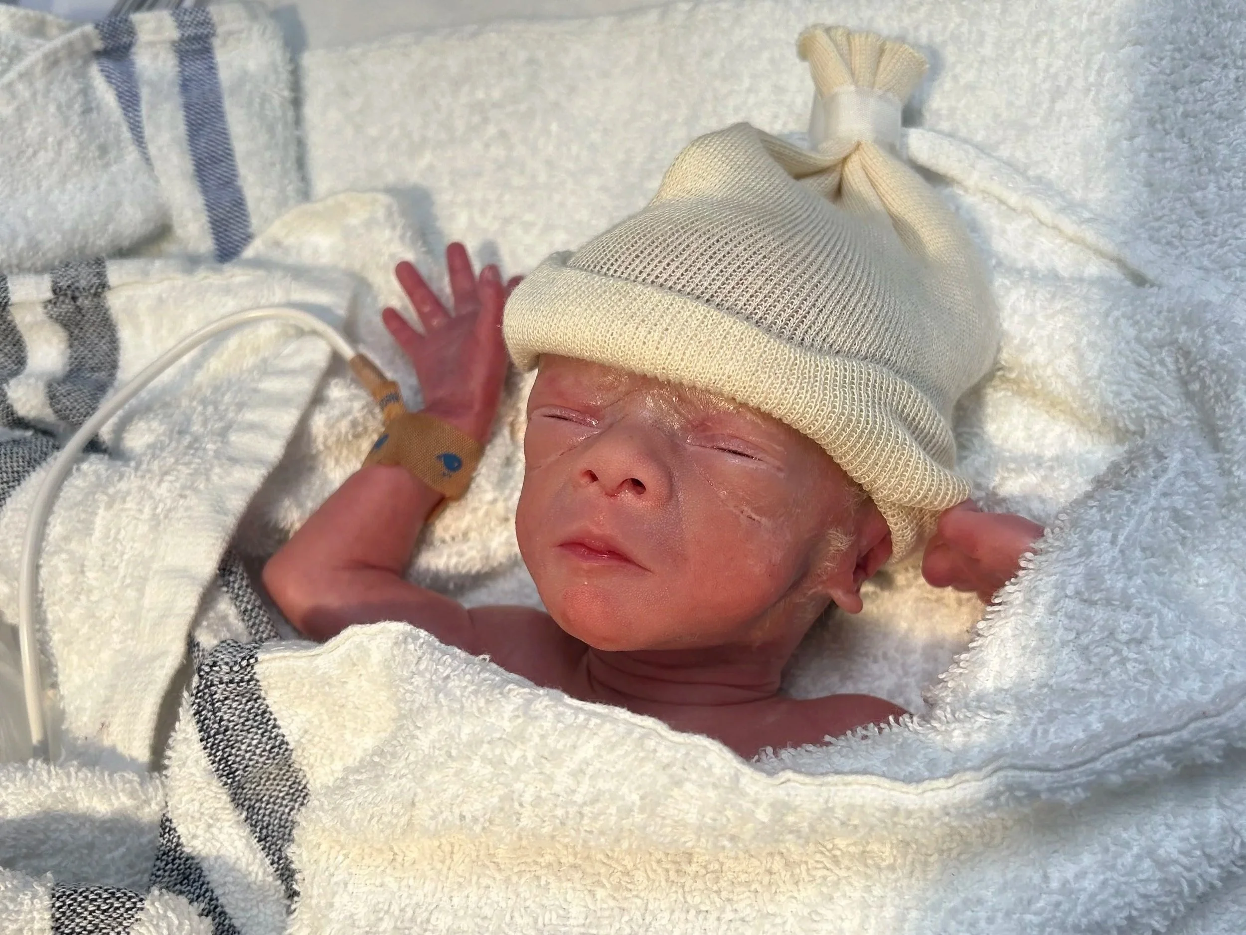Premature and Unplanned C-Section, But Baby is Safe &amp; Happy - Positive Birth Story