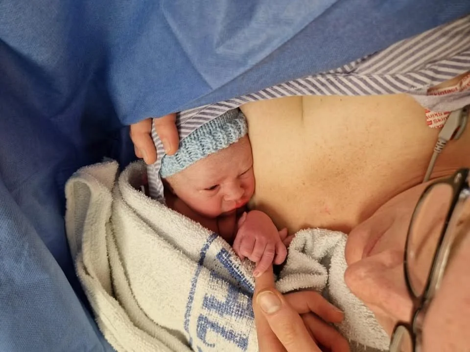 Immediate Skin-to-Skin After C-Section: C-sectionUK Research Results