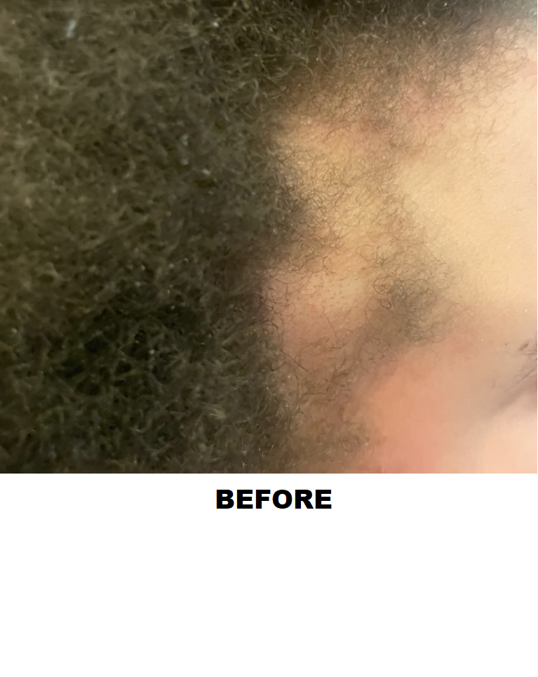 ehscs-hb-before.png