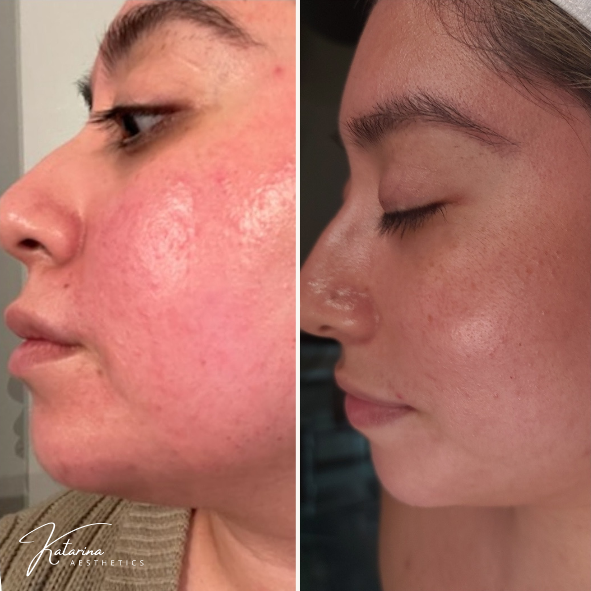 your honest glow, before and after skincare, before and after facial massage, holistic skincare, healthy skincare