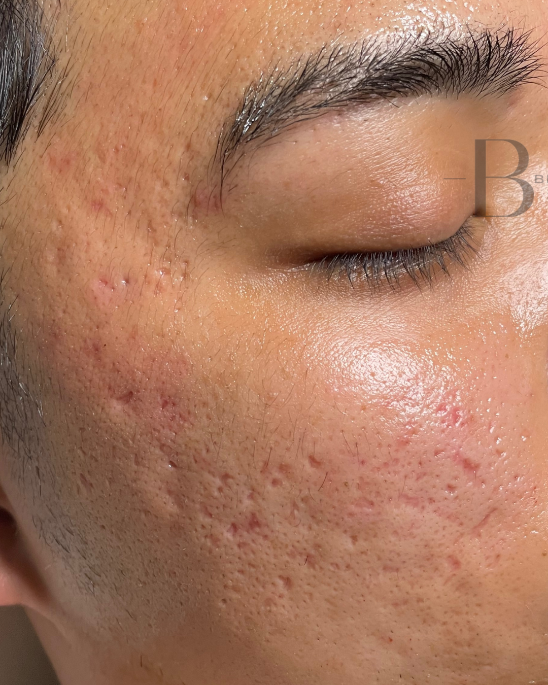 Client before & after results — real transformative outcomes from personalized facials and corrective treatments