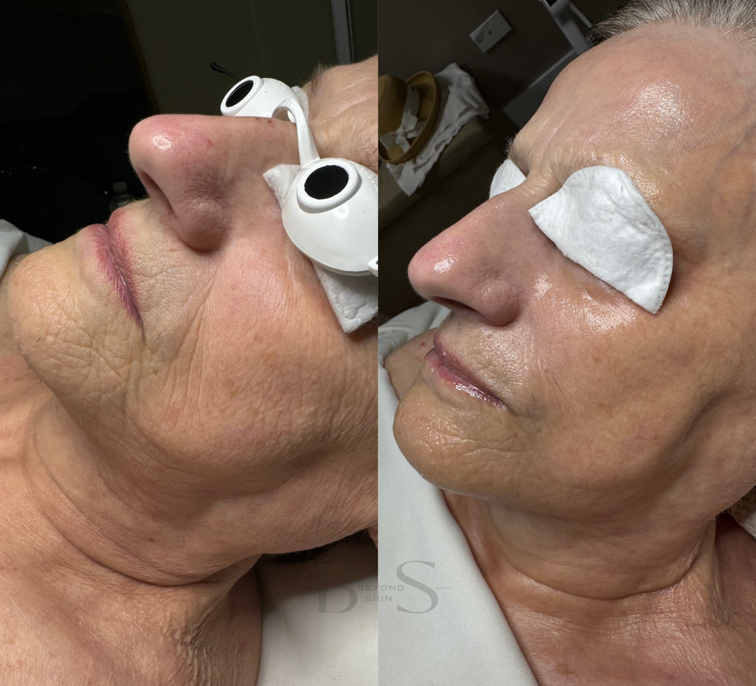 Age-Defying Treatments