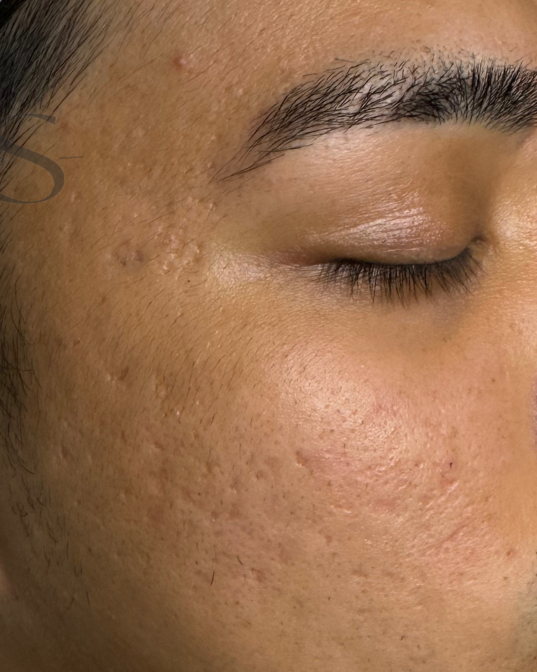 Client before & after results — real transformative outcomes from personalized facials and corrective treatments