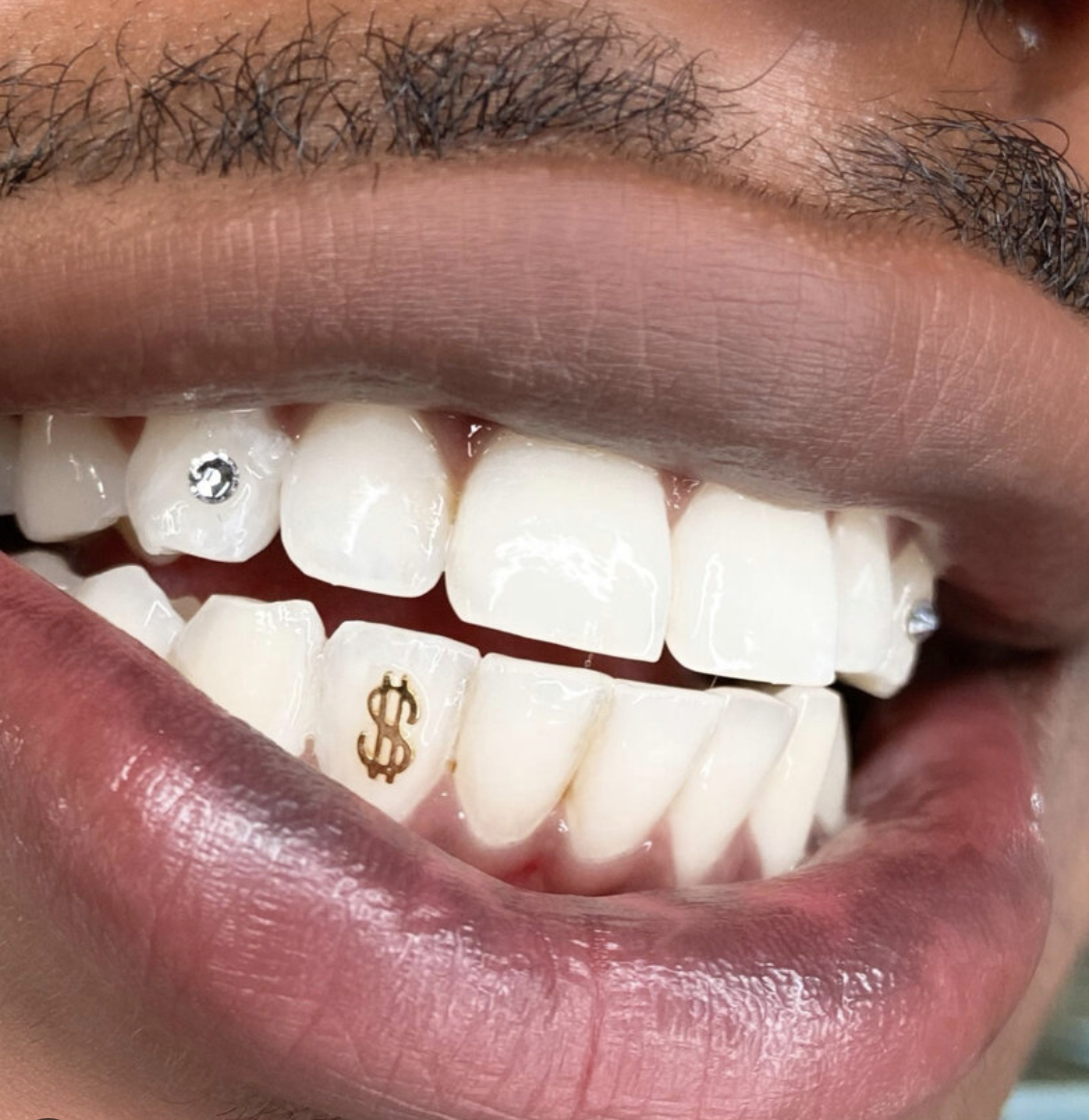 Custom Dental Jewelry Teeth Gem 18K Solid Gold Tooth Gems