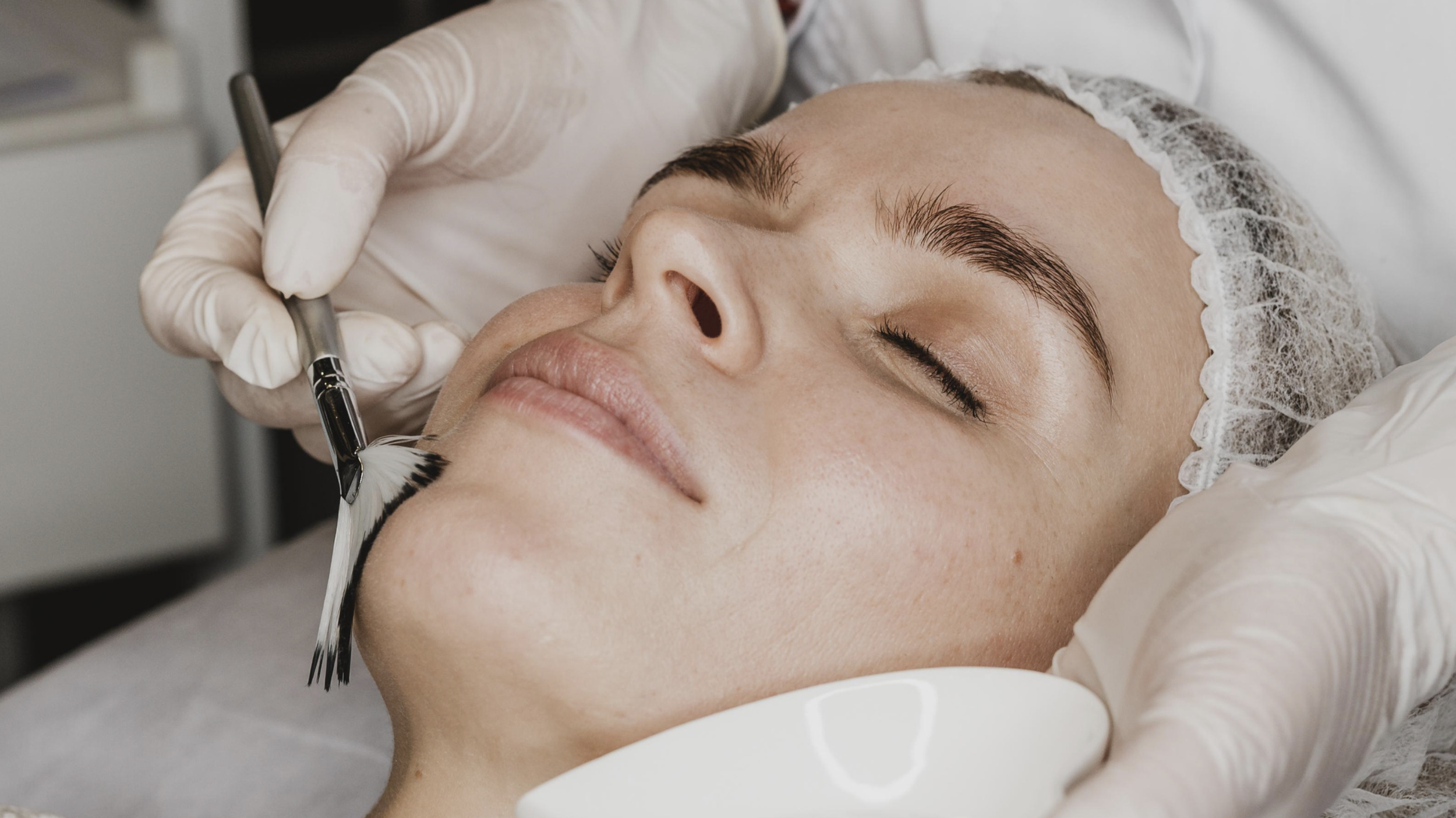 Treating Melasma: A Guide to Melasma Treatment Options and Avoiding Common Pitfalls