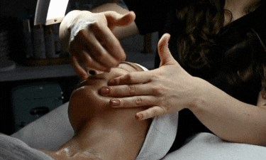 Acne facial results showing clearer, smoother skin in Arizona