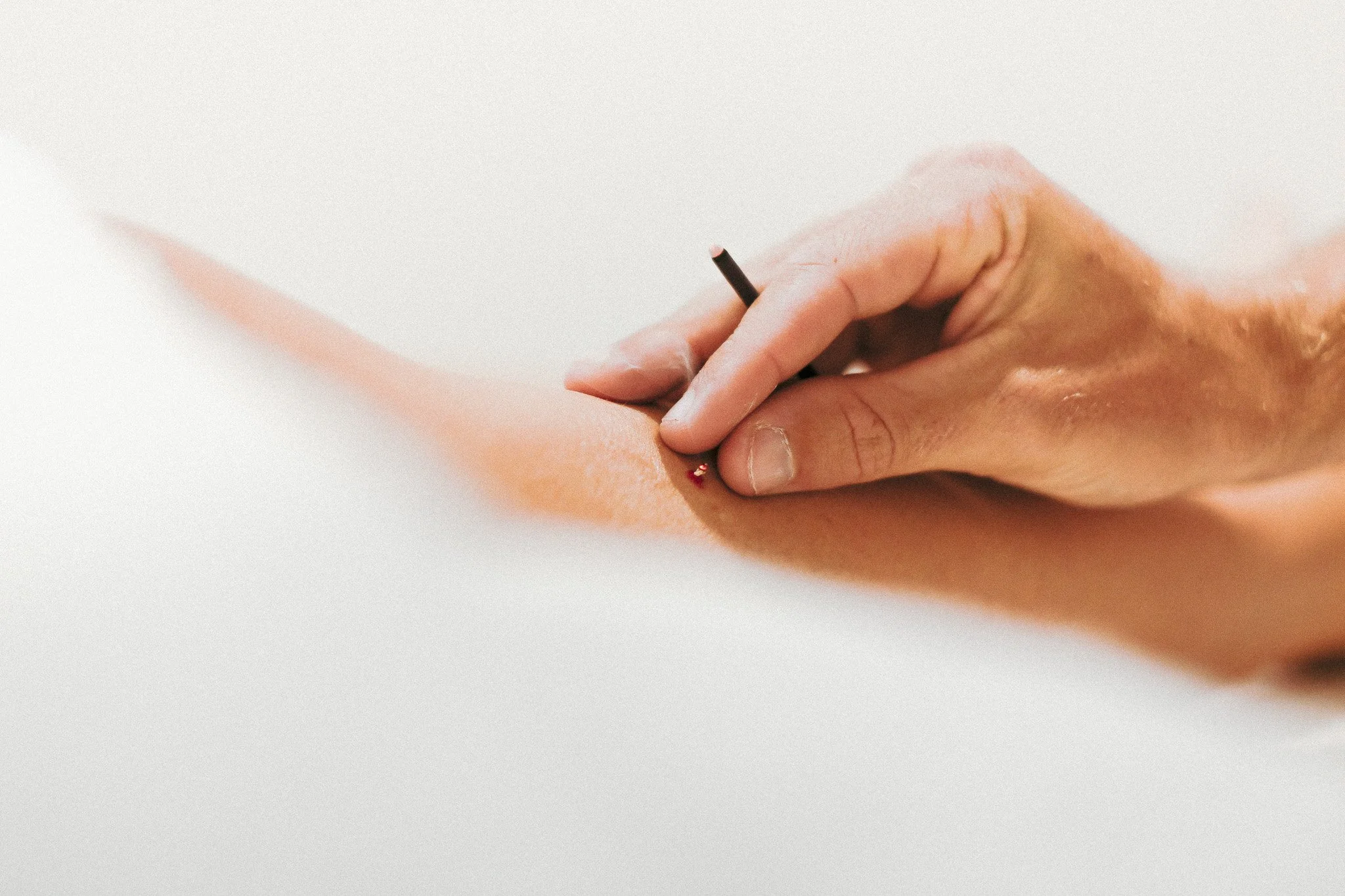 Acupuncture Clinic Near Me Gold Coast Acupuncture Paradise Point