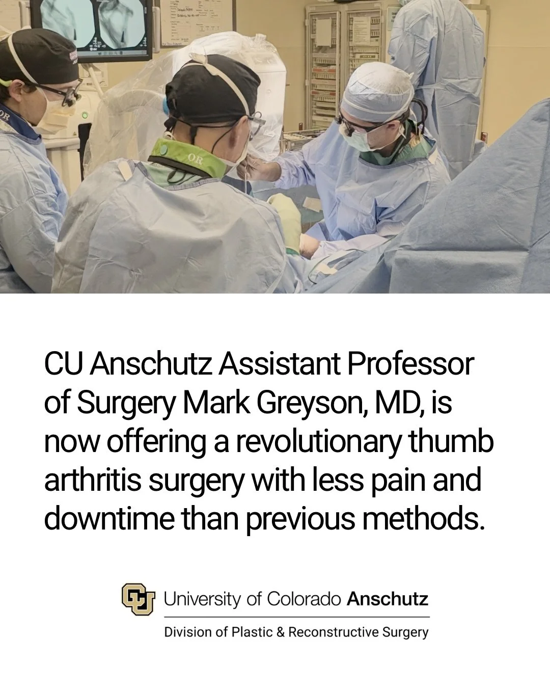 Mark Greyson, MD, is now offering a game-changing thumb arthritis surgery at UCHealth University of Colorado Hospital and UCHealth Central Park. Click through the carousel to learn more about TOUCH CMC Prosthesis Joint Replacement, its benefits, surg