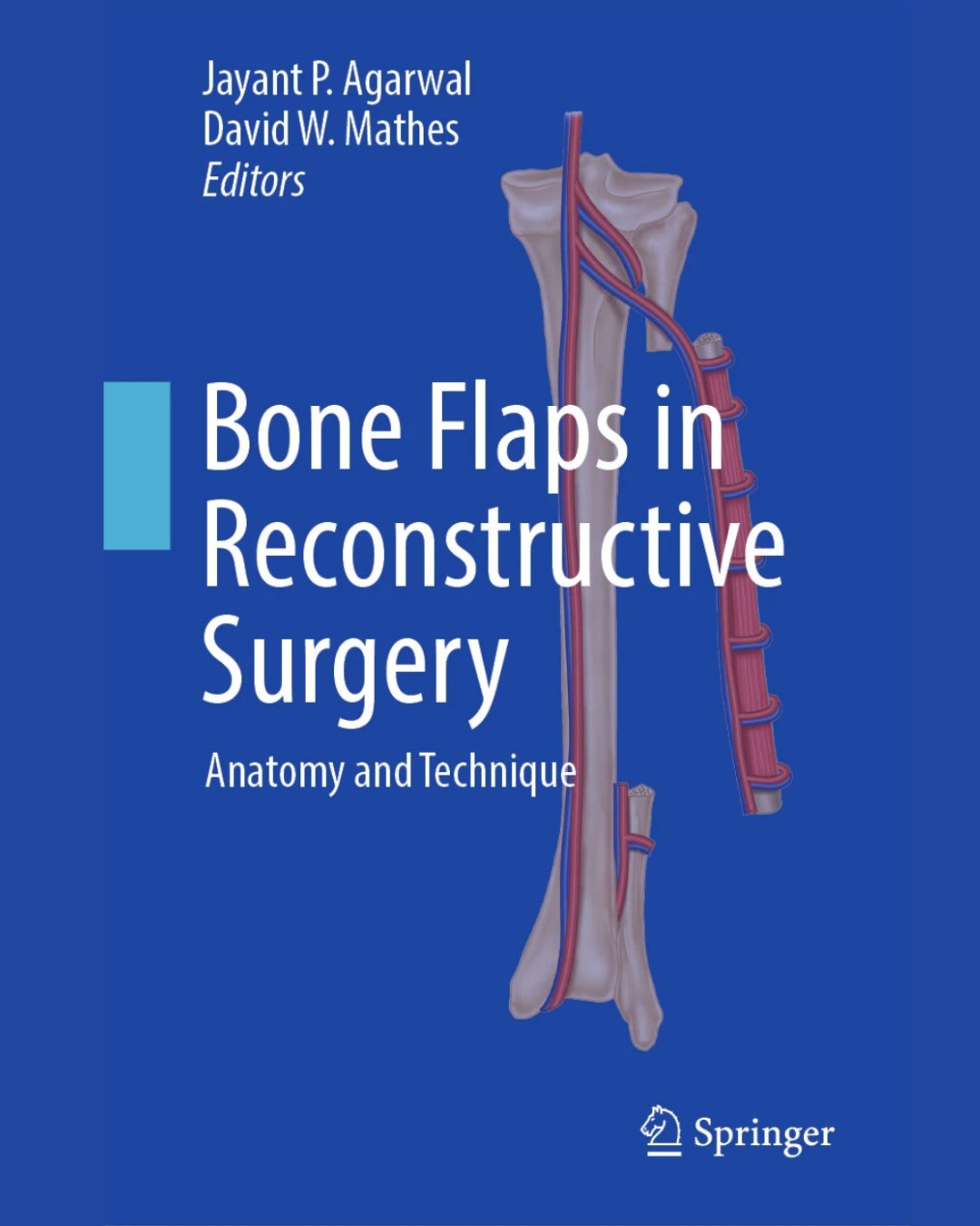Click our link in bio to purchase "Bone Flaps in Reconstructive Surgery," edited by Jayant P. Agarwal, MD, and David W. Mathes, MD. ⁠
⁠
While there are several texts readily available on flaps and reconstructive surgery, this book is an exc