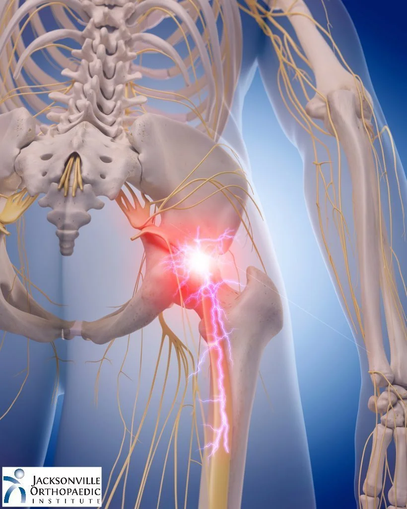 Chiropractic Care for Sciatica: Gentle Relief Through Spinal Adjustments