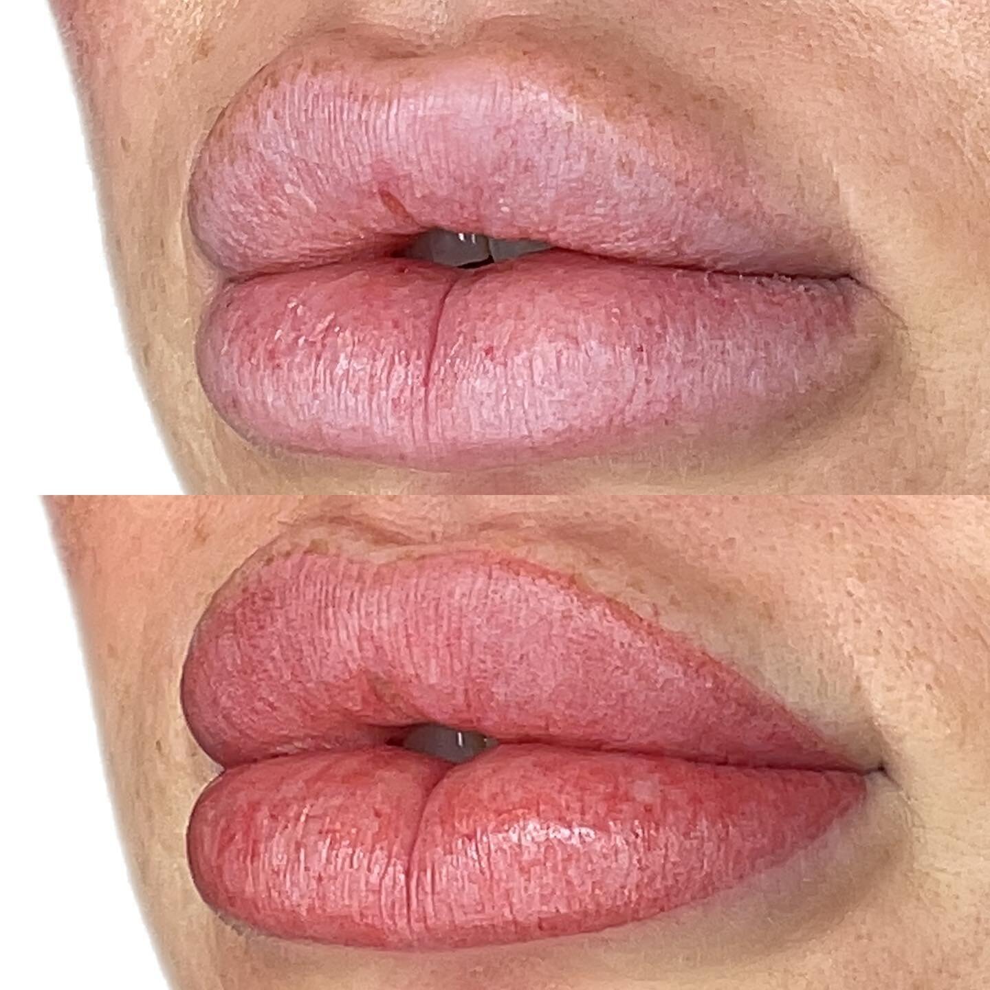 First session lip blush 💋

⏩︎ More defined border
⏩︎ Enhanced colour

Her healed results from this session will be very soft and natural. We will follow up with a second session in six weeks to add more layers of shading for a bolder and more define