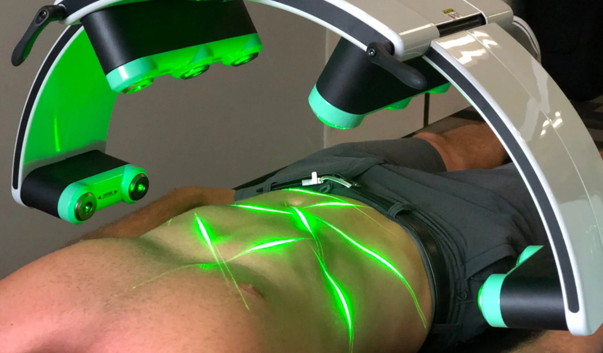 What Happens to Fat Cells During Green Laser Body Contouring?