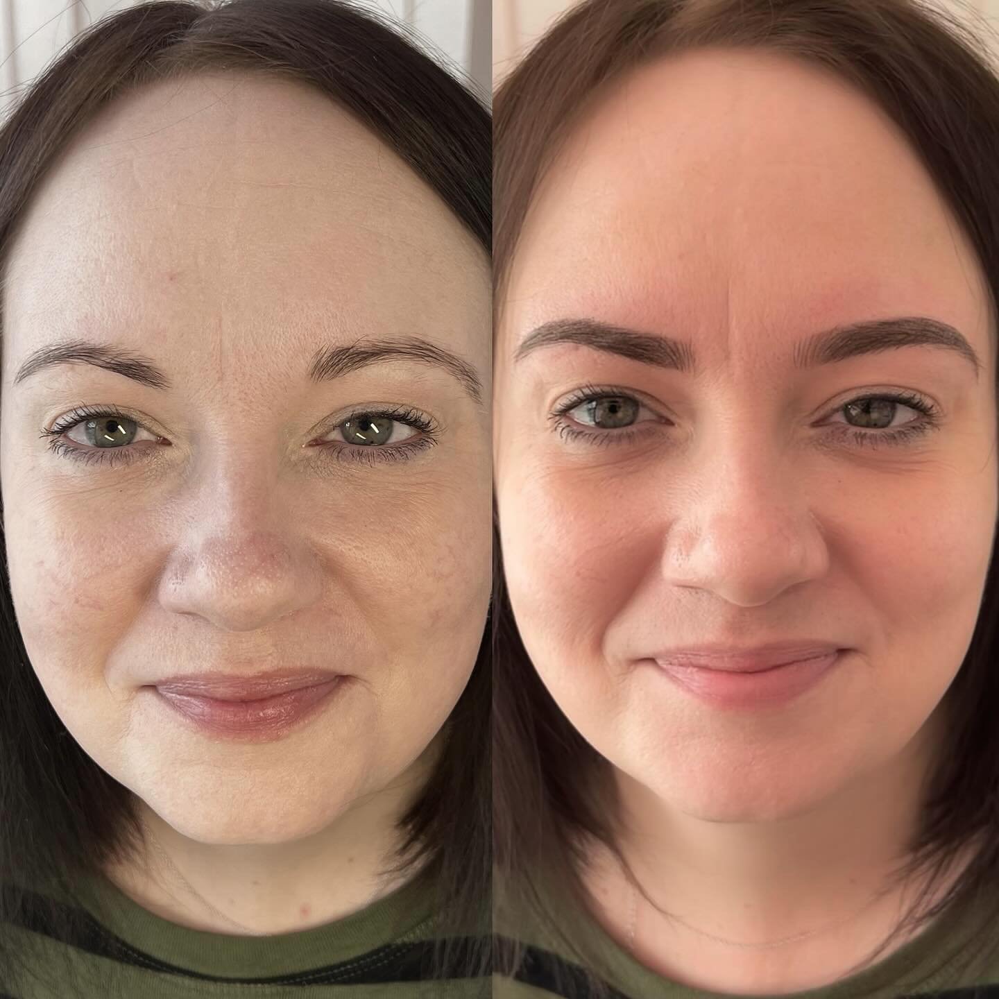𝑪𝒐𝒎𝒃𝒊𝒏𝒂𝒕𝒐𝒏 𝑩𝒓𝒐𝒘𝒔.

My client Lisa is a natural beauty who wanted an enhancement that makeup couldn&rsquo;t achieve.

I balanced out the symmetry of the natural brows, lifted the arches and my client was so happy with her new look.

The