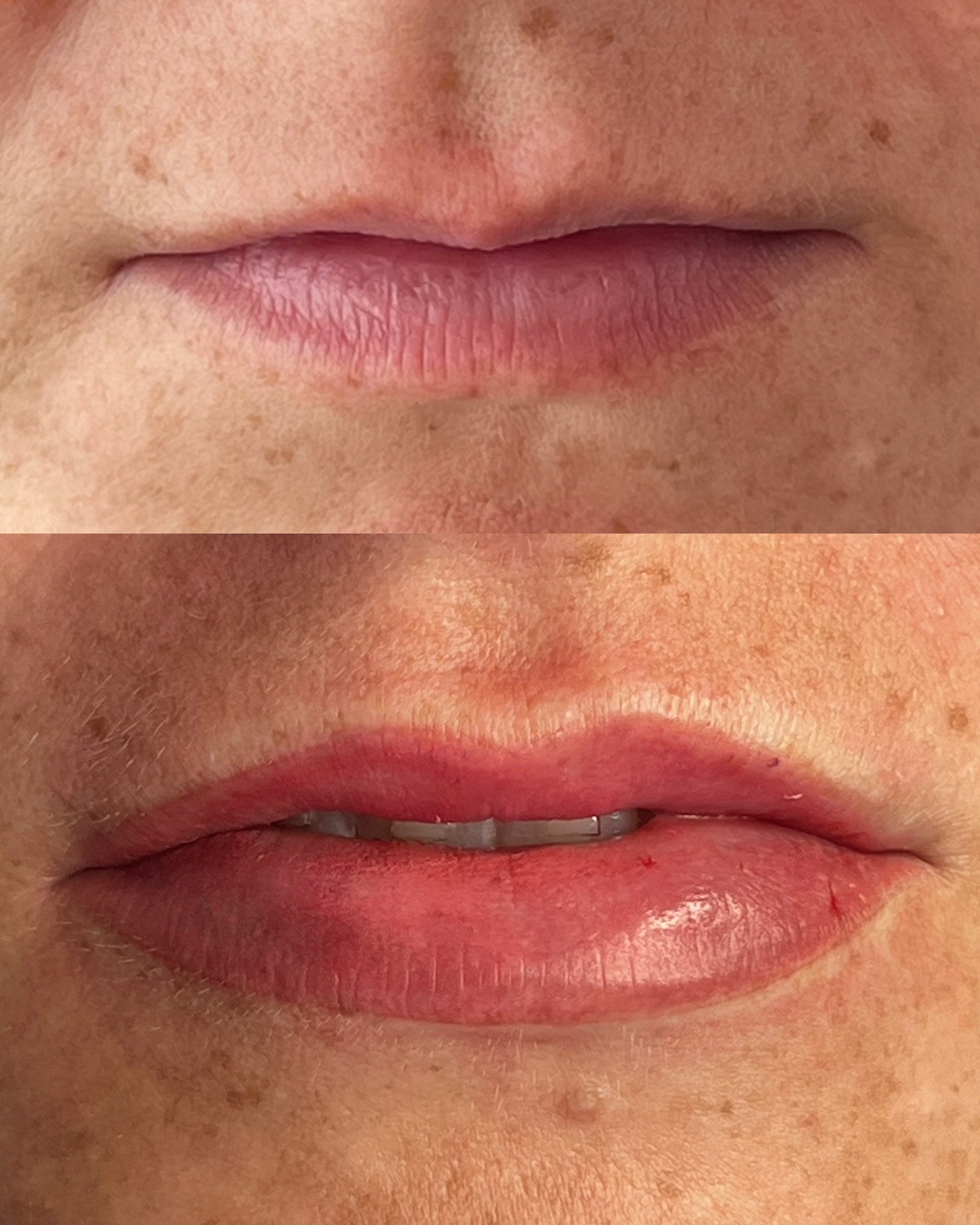Lip blush 101: why it always heals soft and natural.

The lips are very vascular (aka lots of blood flow), which means the pigment settles into the skin differently than the brows. You won&rsquo;t get a harsh or heavy look, just a soft blush that enh