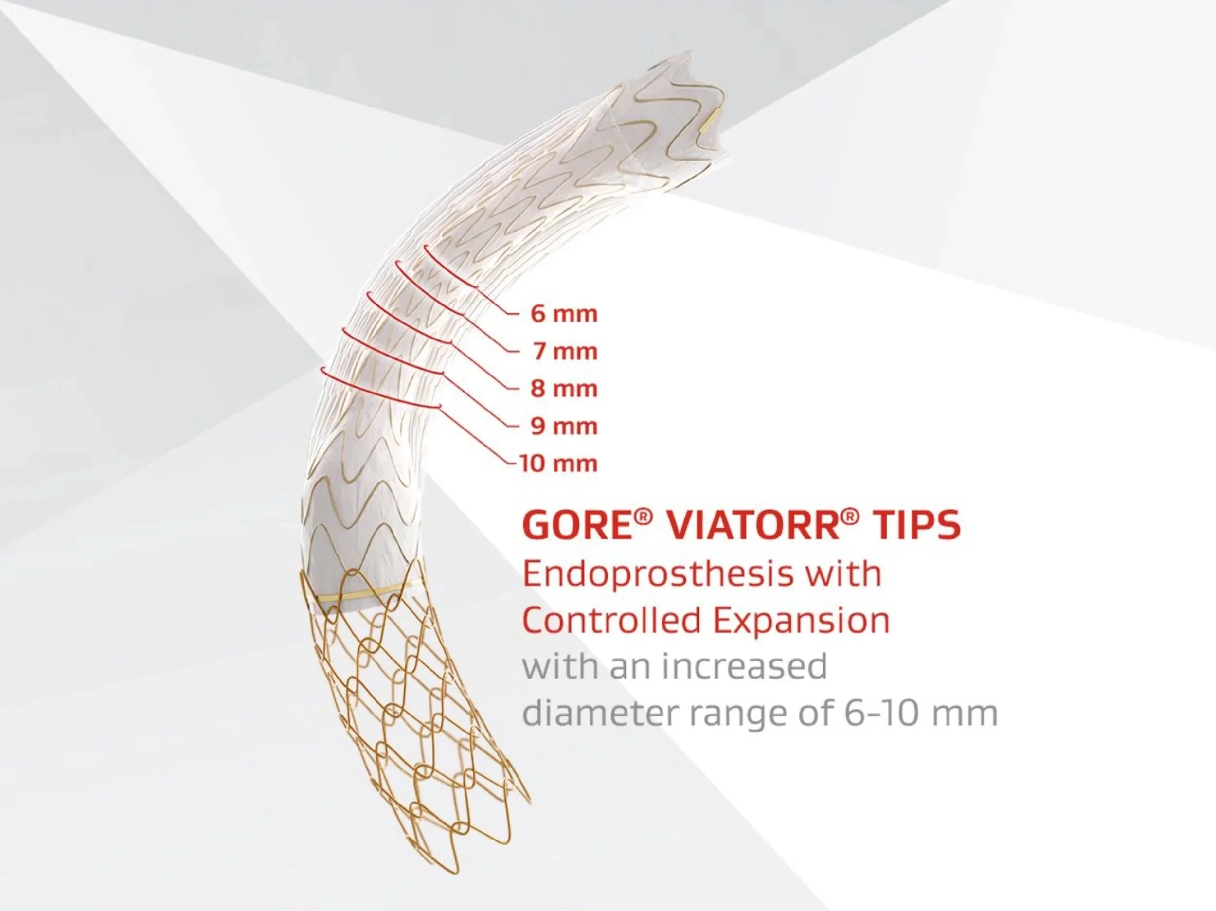 Positioning Market Leading Hepatic Stent Graft
