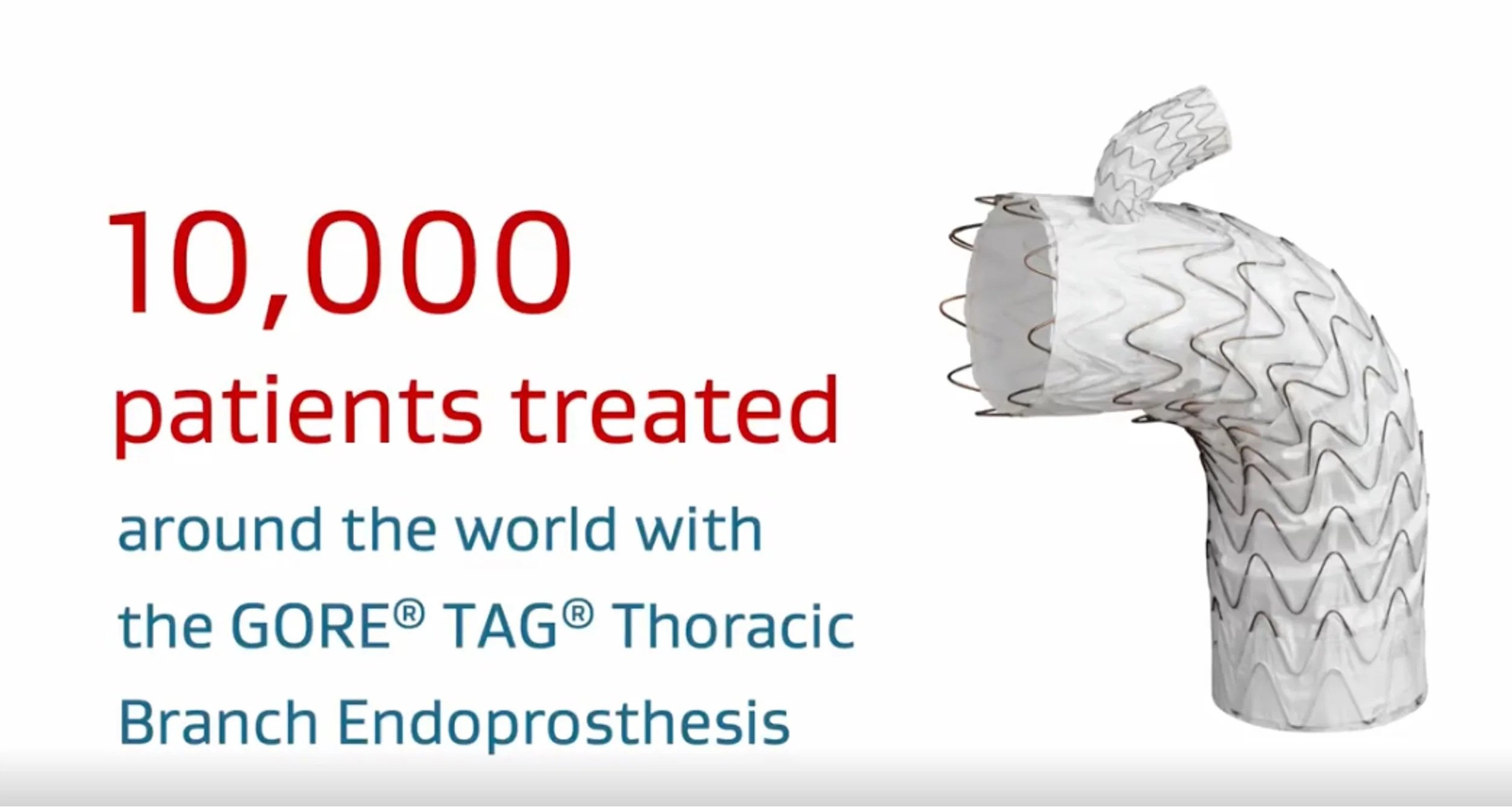 Positioning For Market Leading Aortic Stent-Graft