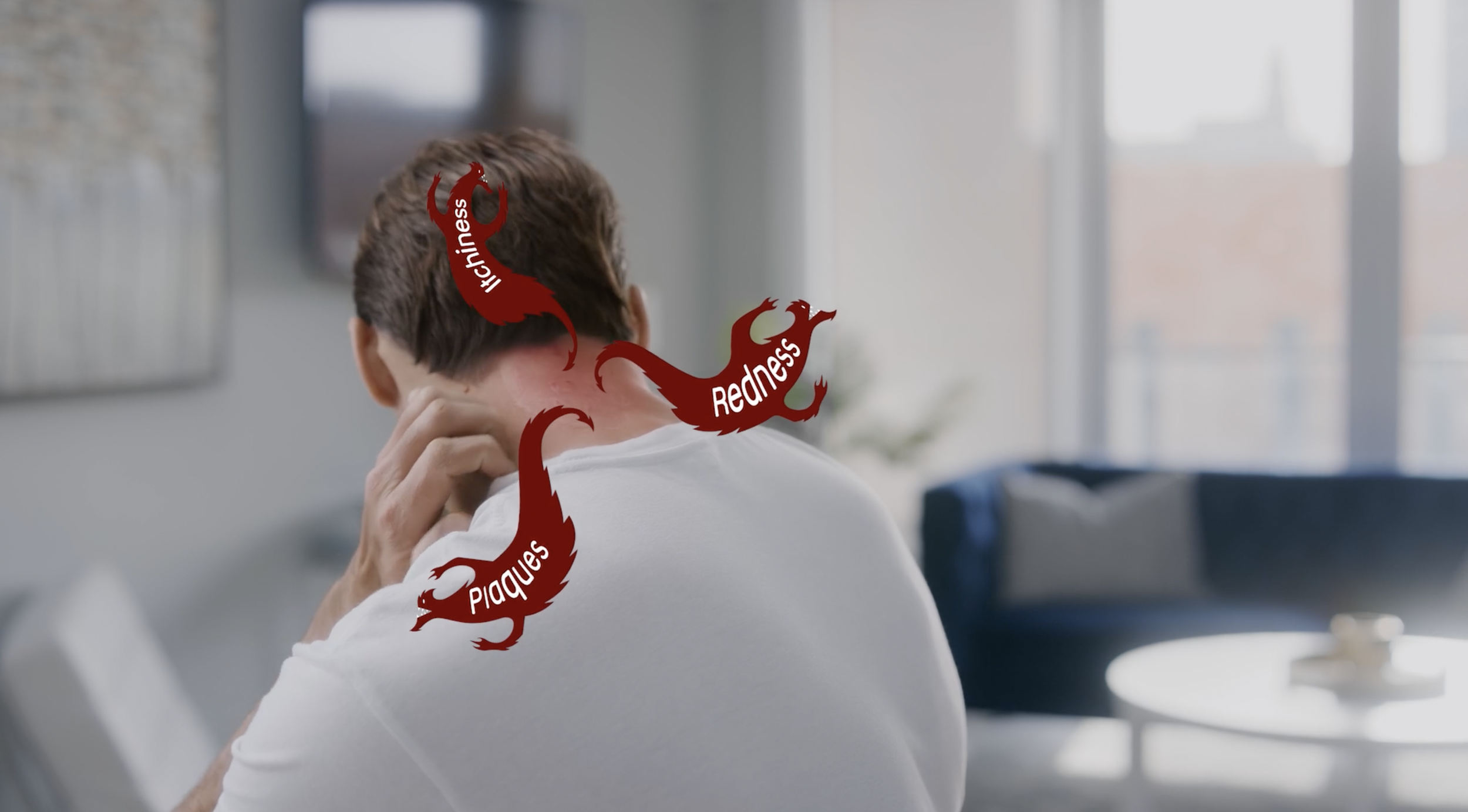 dragons coming out of psoriasis neck.png