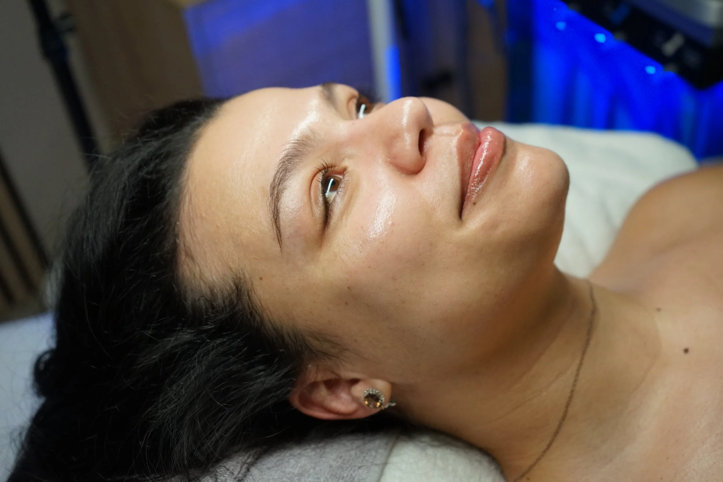 GLASS SKIN, POST HYDRAFACIAL, HYDRAFACIAL TREATMENT, GLOWING SKIN