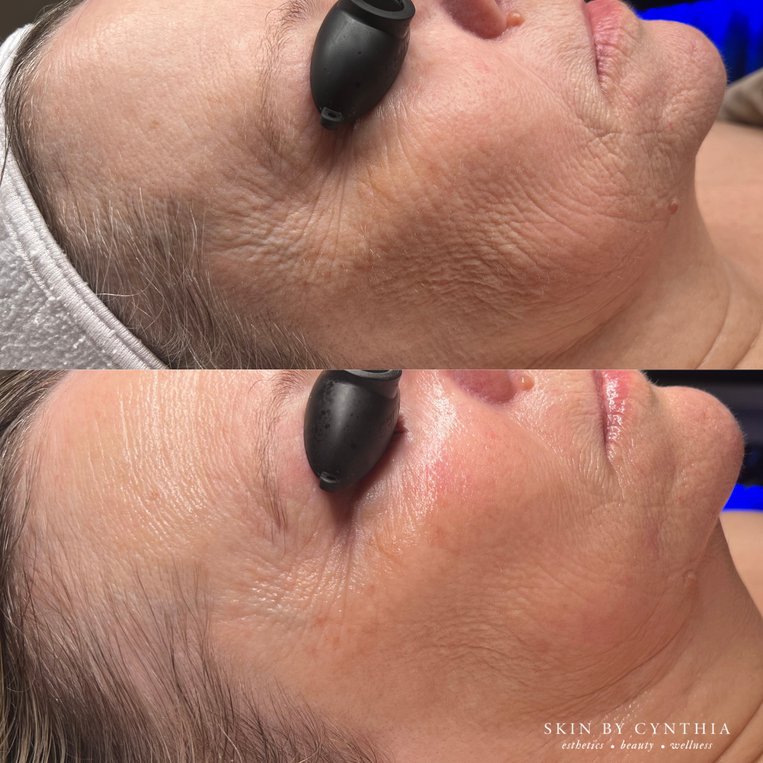 Skin, Elevated: Click to Learn More