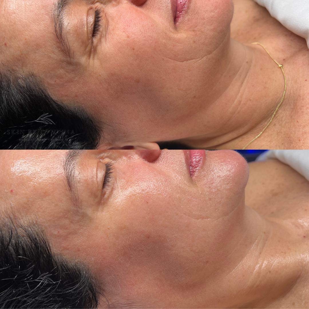 Before and after ProAging.png