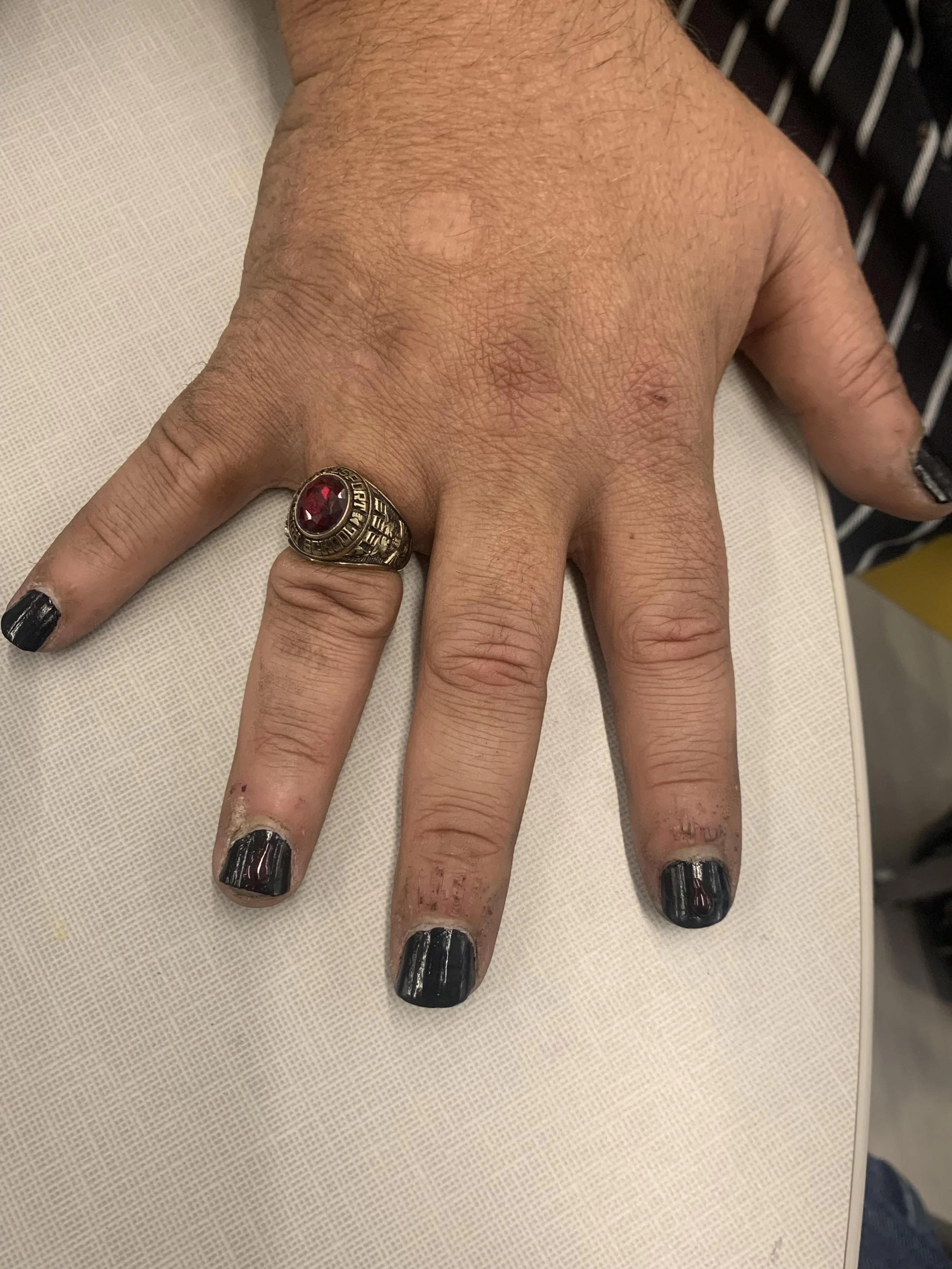 Second Avenue Commons