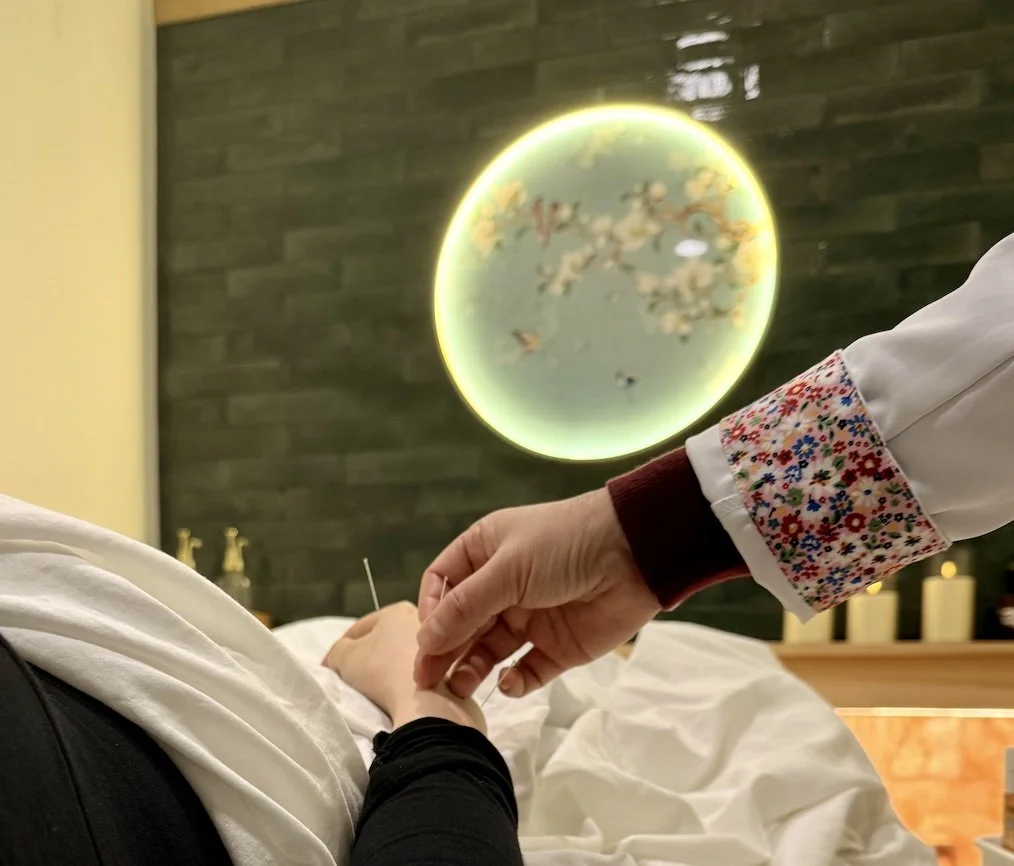 Thinking About Acupuncture? Start Here
