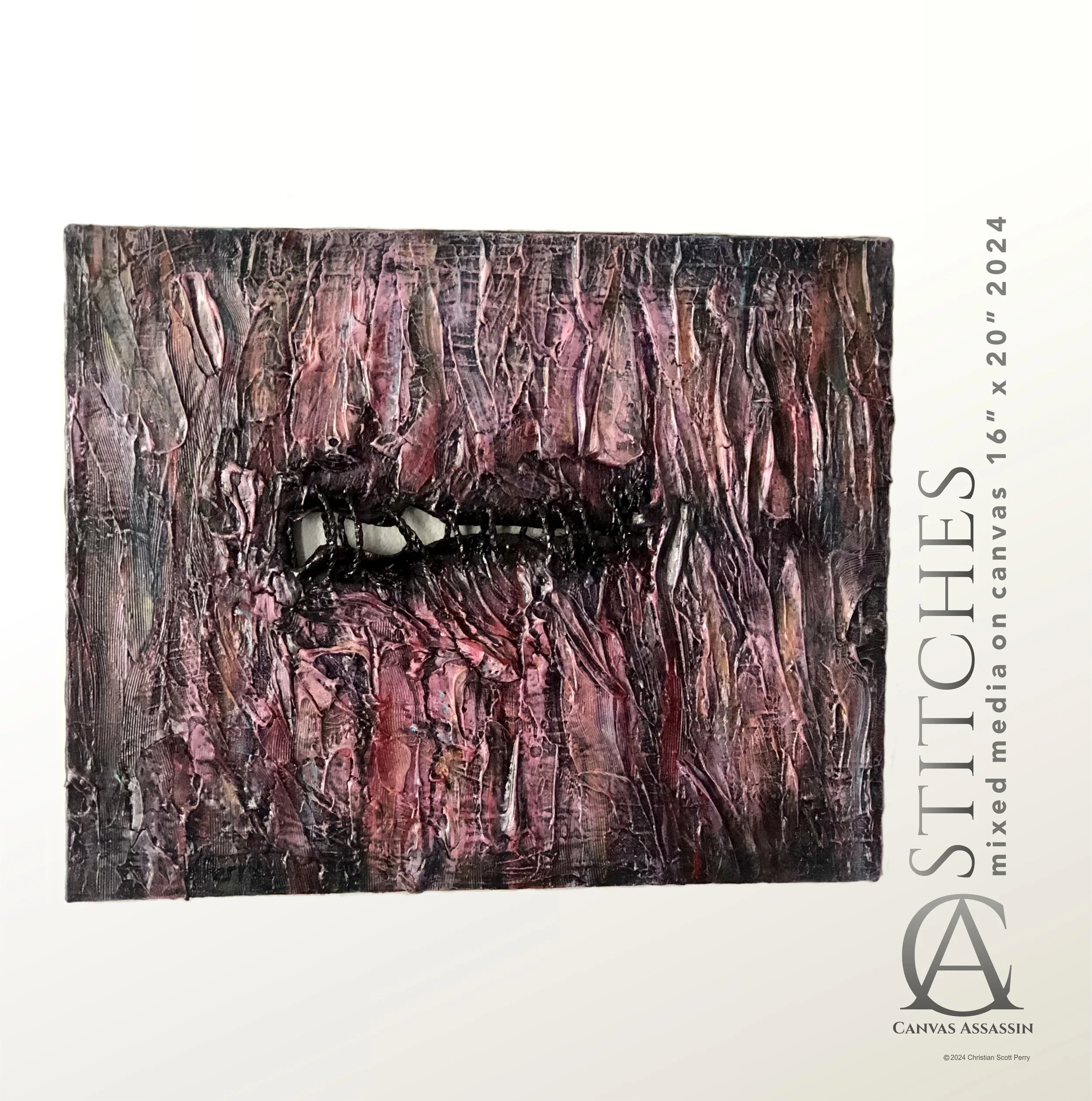 Stitches